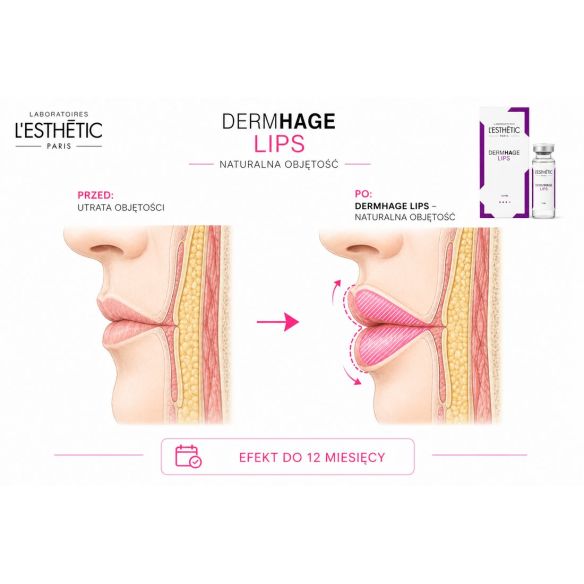 DERMHAGE Lips – Wypłniacz HA do Modelowania Ust 1ml