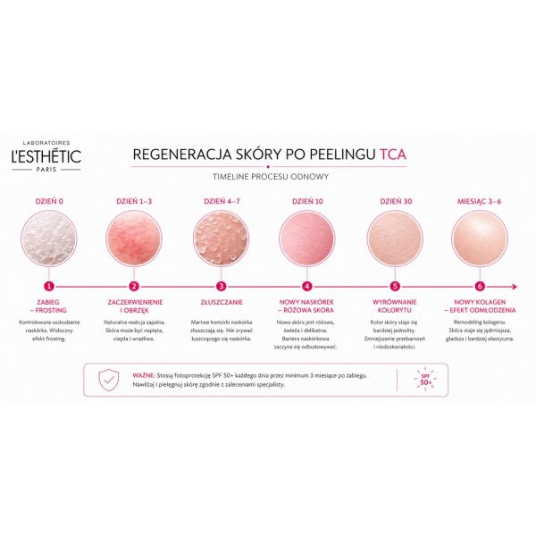 Anti-Aging PEEL – Peeling...
