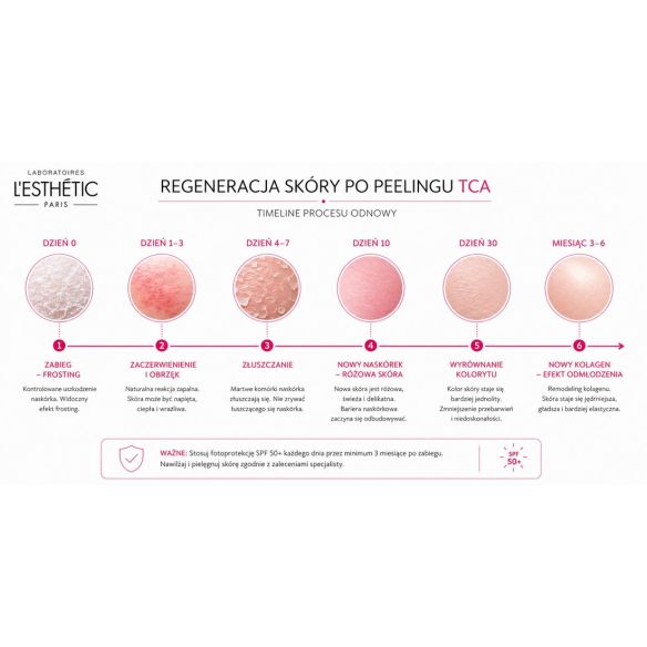 Anti-Aging PEEL – Peeling Odmładzający TCA do Twarzy 50ml