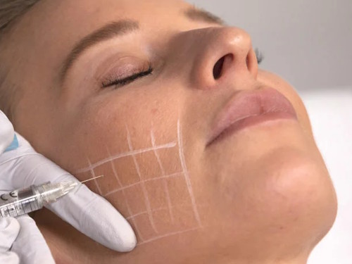 Stymulatory tkankowe Efekt