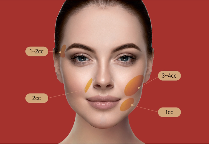 Etrebelle PCL 200 mg działanie