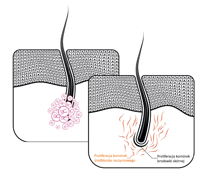 Exoxe Hair Zastosowanie