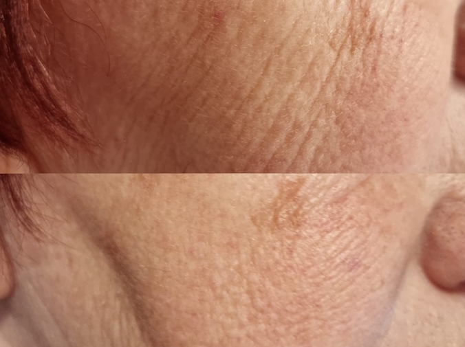 Gouri before after 2