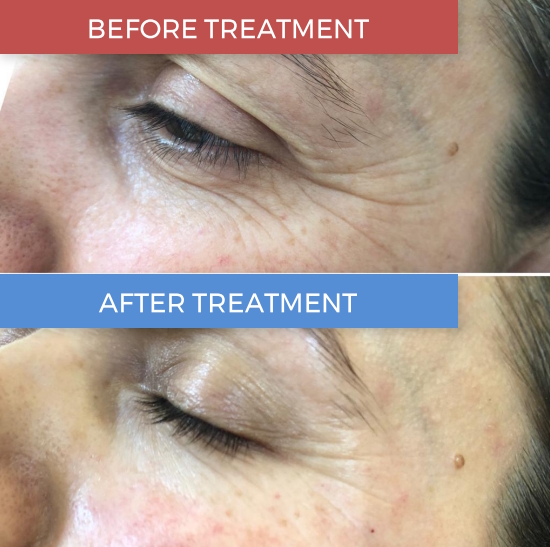 Miracle Seria do po 1