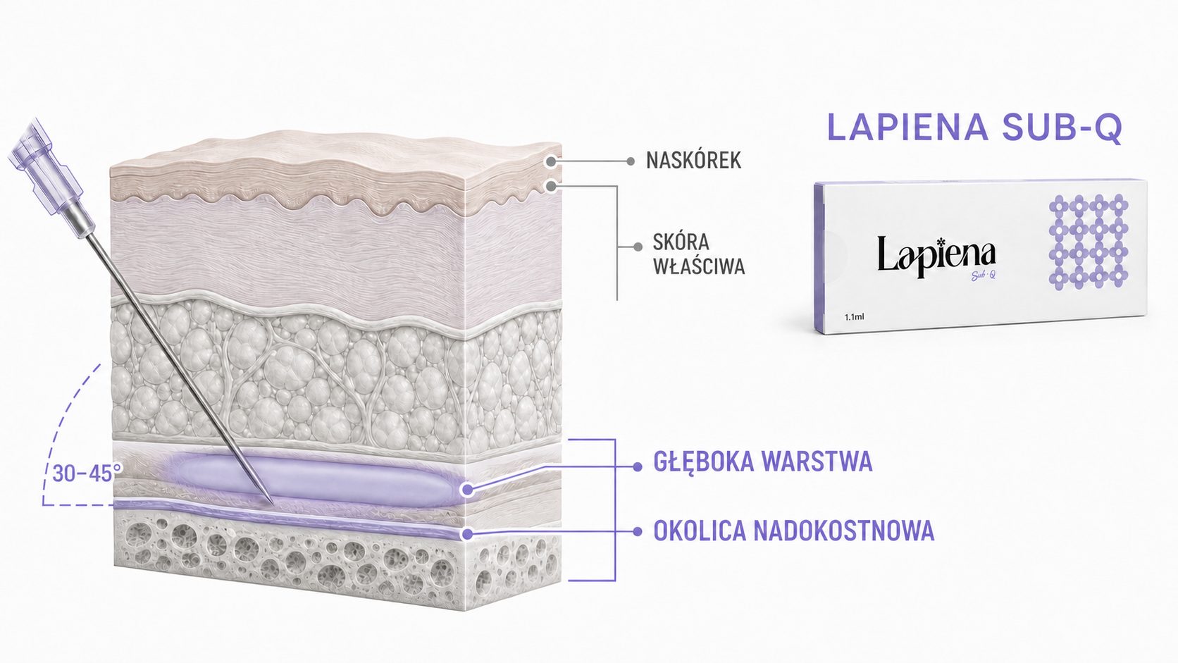 Lapiena Sub-Q – schemat głębokiego podania i okolicy nadokostnowej