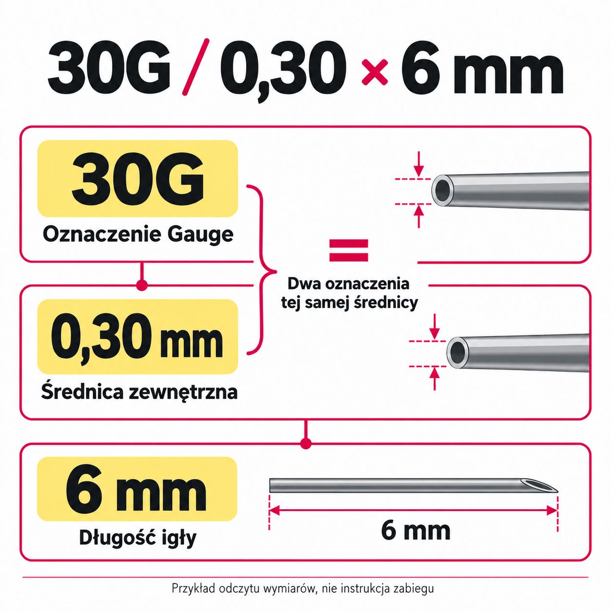 Przykład odczytu oznaczenia igły 30G × 6 mm: średnica 0,30 mm i długość 6 mm