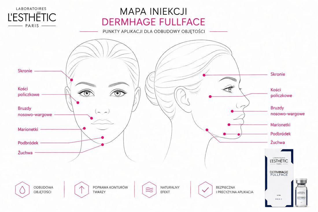 DERMHAGE Fullface – mapa punktów iniekcji modelowanie twarzy