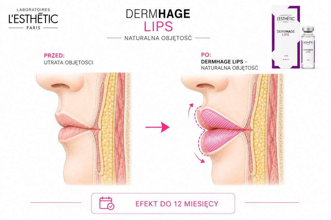 DERMHAGE Lips – efekt powiększenia ust przed i po