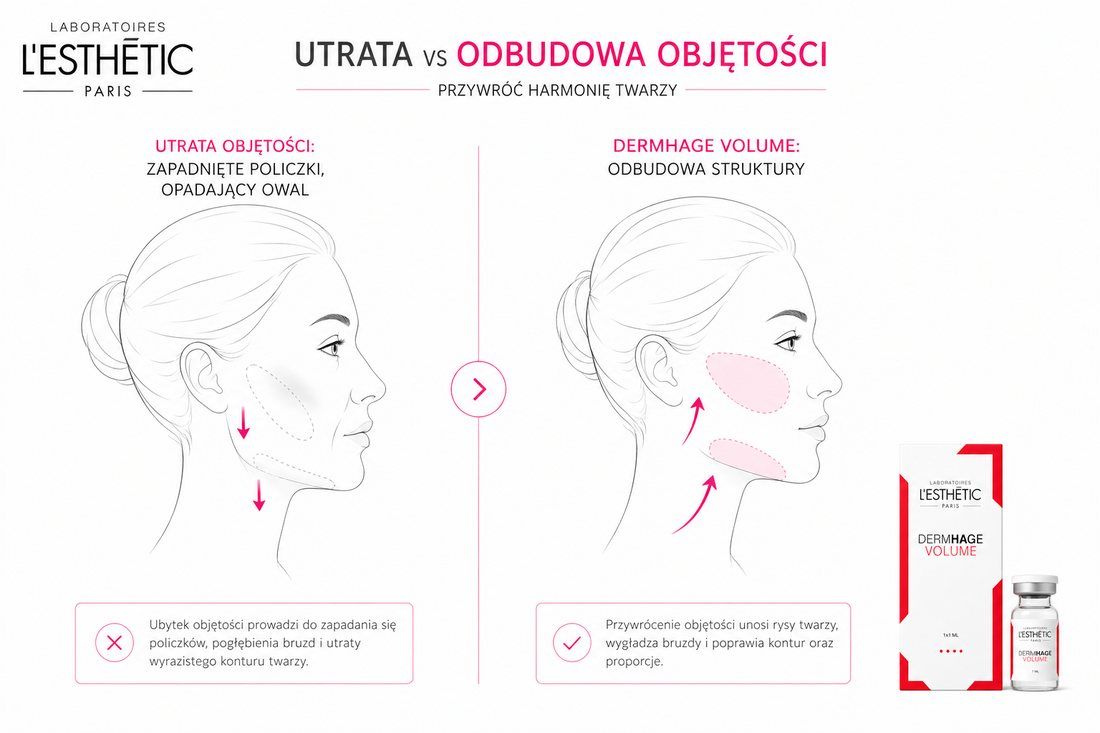 DERMHAGE Volume – lifting wolumetryczny twarzy przed i po