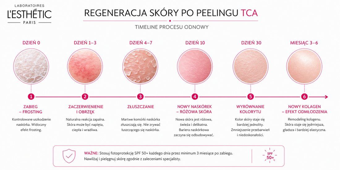 Anti-Aging PEEL TCA – harmonogram regeneracji skóry po zabiegu